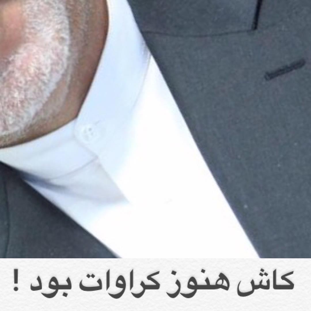 یقه آخوندی