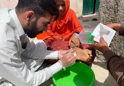 درمان رایگان بیماران محروم سیستان و بلوچستان
